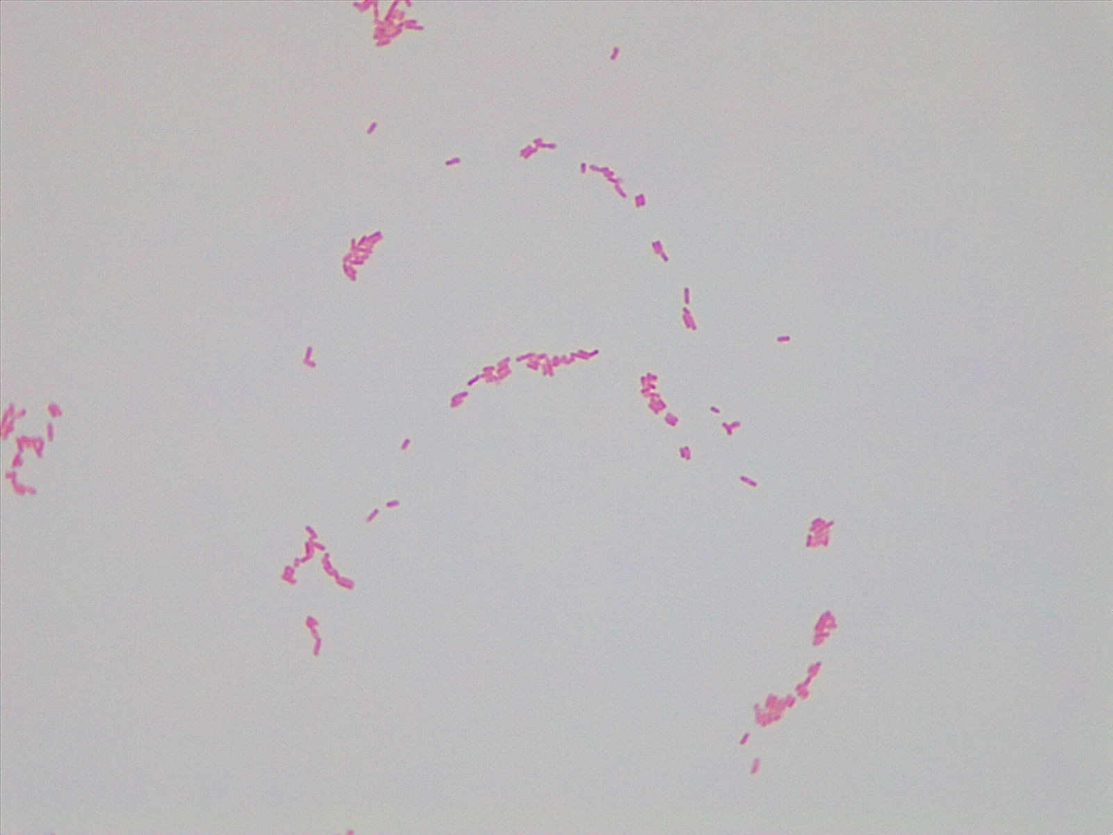 Micrograph Enterobacter Aerogenes Gram Stain 1000X P000175 OER Commons