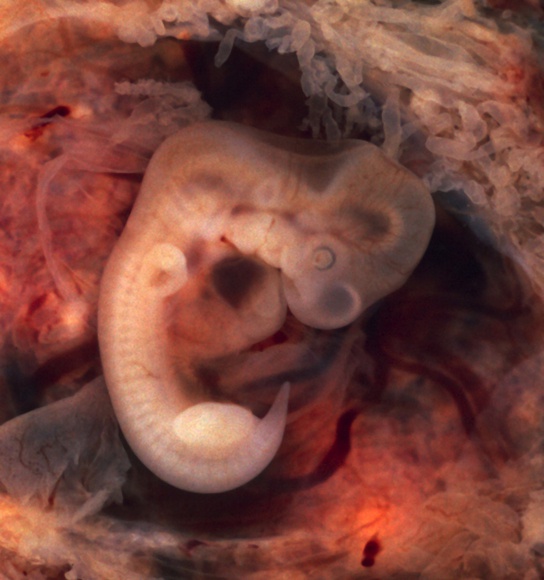 Organogenesis and Vertebrate Formation