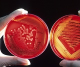 Biology, Biological Diversity, Prokaryotes: Bacteria and Archaea, Prokaryotic Diversity