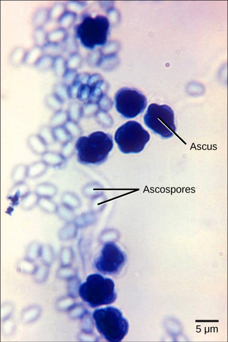 Classifications of Fungi