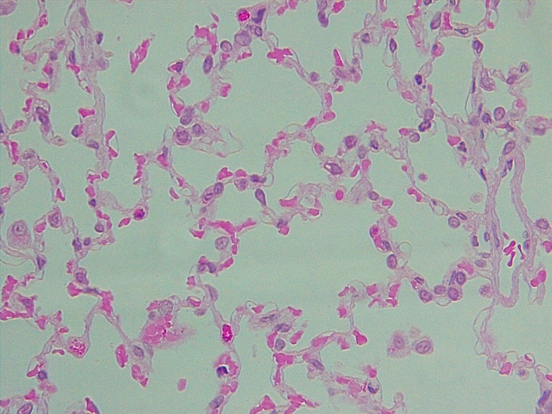 simple squamous epi_lung alveoli_400x, p000120 OER Commons